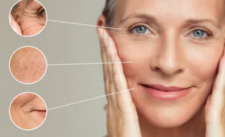 La menopausa